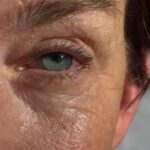 oog