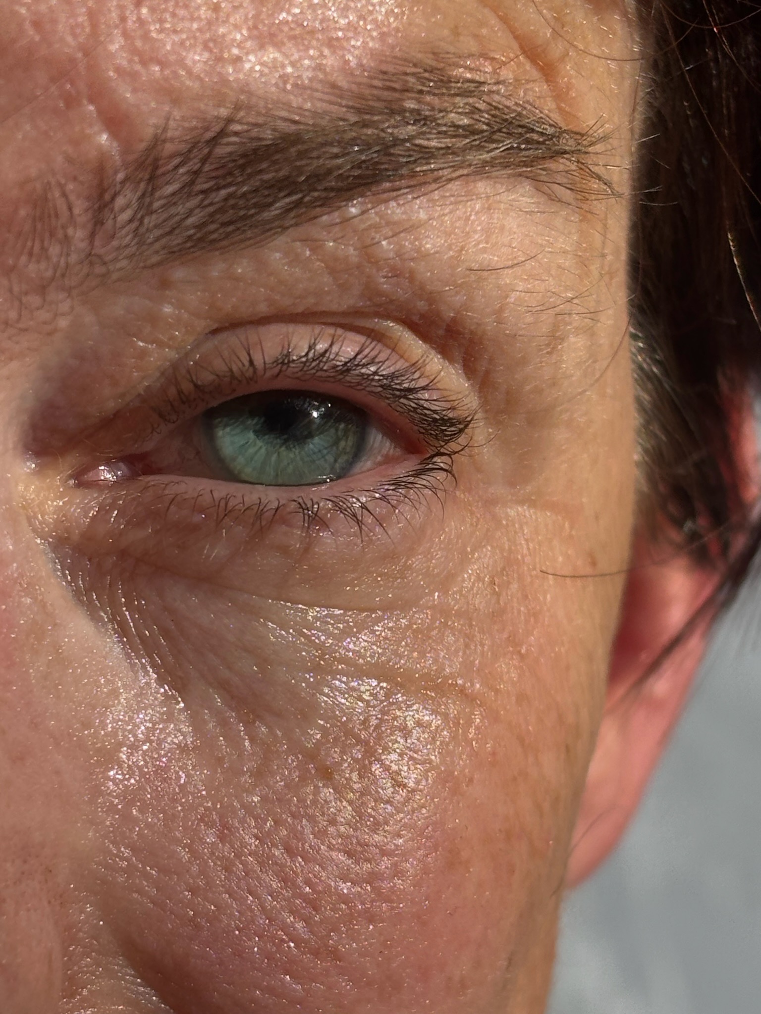 oog